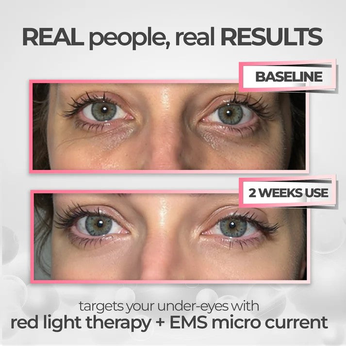 LuminEyes™ Under-Eye Red Light Therapy